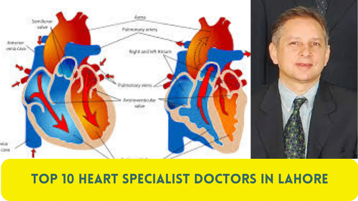 Top 10 Heart Specialist Doctors in Lahore